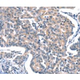 Immunohistochemistry - CACNA1A Antibody from Signalway Antibody (37454) - Antibodies.com