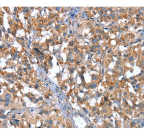 Immunohistochemistry - CACNA1G Antibody from Signalway Antibody (37455) - Antibodies.com