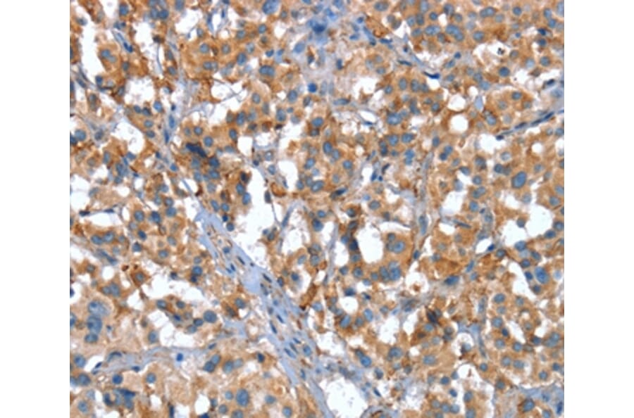 Immunohistochemistry - CACNA1G Antibody from Signalway Antibody (37455) - Antibodies.com