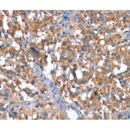 Immunohistochemistry - CACNA1G Antibody from Signalway Antibody (37455) - Antibodies.com