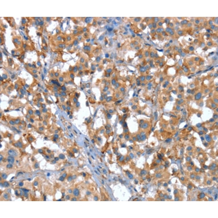 Immunohistochemistry - CACNA1G Antibody from Signalway Antibody (37455) - Antibodies.com