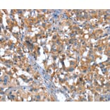 Immunohistochemistry - CACNA1G Antibody from Signalway Antibody (37455) - Antibodies.com