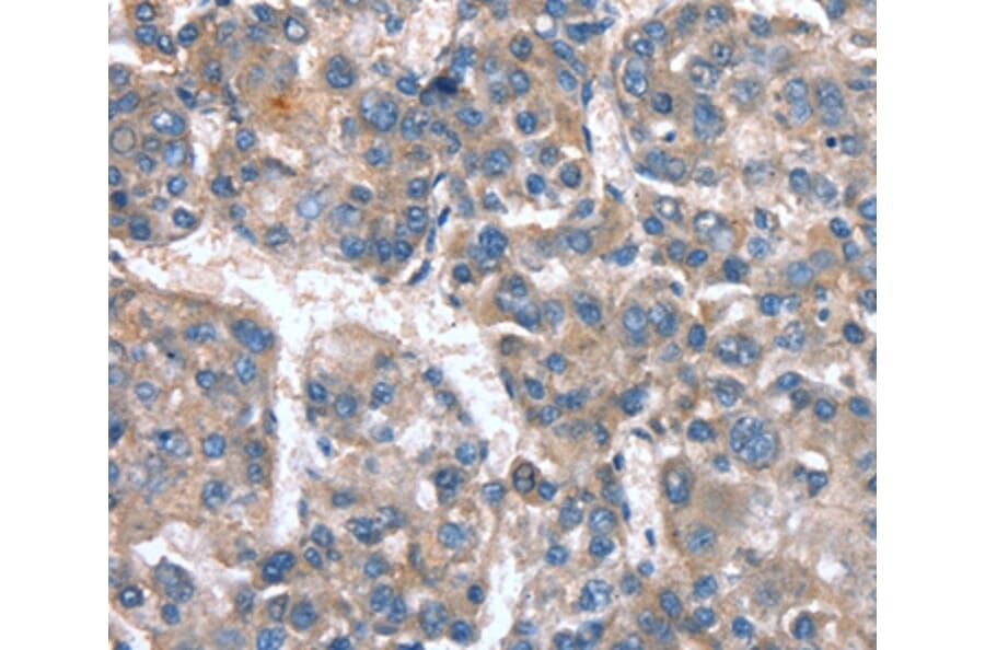 Immunohistochemistry - CACNA1G Antibody from Signalway Antibody (37455) - Antibodies.com