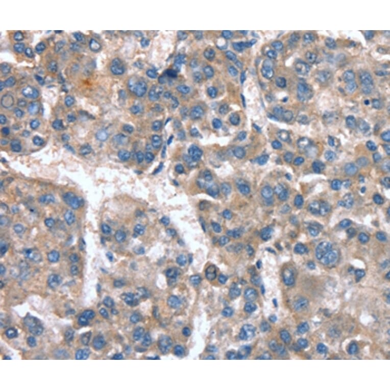 Immunohistochemistry - CACNA1G Antibody from Signalway Antibody (37455) - Antibodies.com