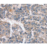 Immunohistochemistry - CACNA1G Antibody from Signalway Antibody (37455) - Antibodies.com