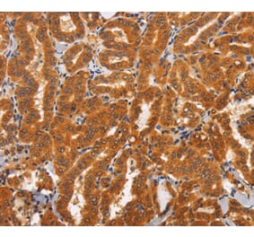 Immunohistochemistry - TNFRSF8 Antibody from Signalway Antibody (37469) - Antibodies.com