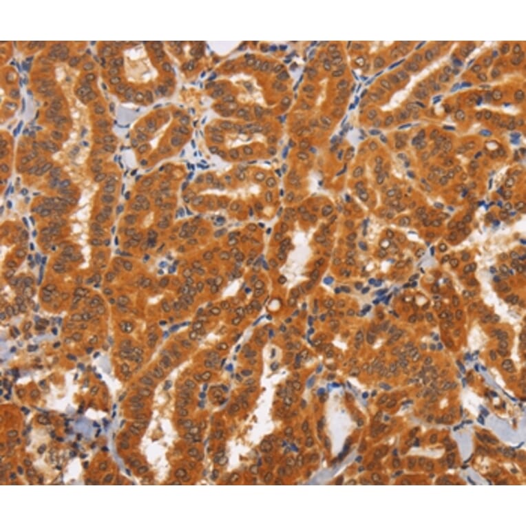 Immunohistochemistry - TNFRSF8 Antibody from Signalway Antibody (37469) - Antibodies.com