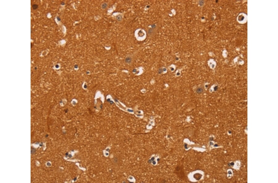 Immunohistochemistry - TNFRSF8 Antibody from Signalway Antibody (37469) - Antibodies.com
