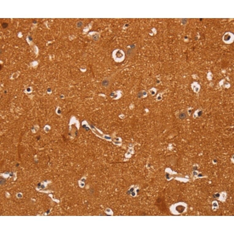 Immunohistochemistry - TNFRSF8 Antibody from Signalway Antibody (37469) - Antibodies.com