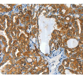 Immunohistochemistry - CLPTM1L Antibody from Signalway Antibody (37492) - Antibodies.com