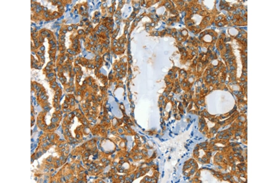 Immunohistochemistry - CLPTM1L Antibody from Signalway Antibody (37492) - Antibodies.com