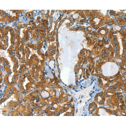 Immunohistochemistry - CLPTM1L Antibody from Signalway Antibody (37492) - Antibodies.com