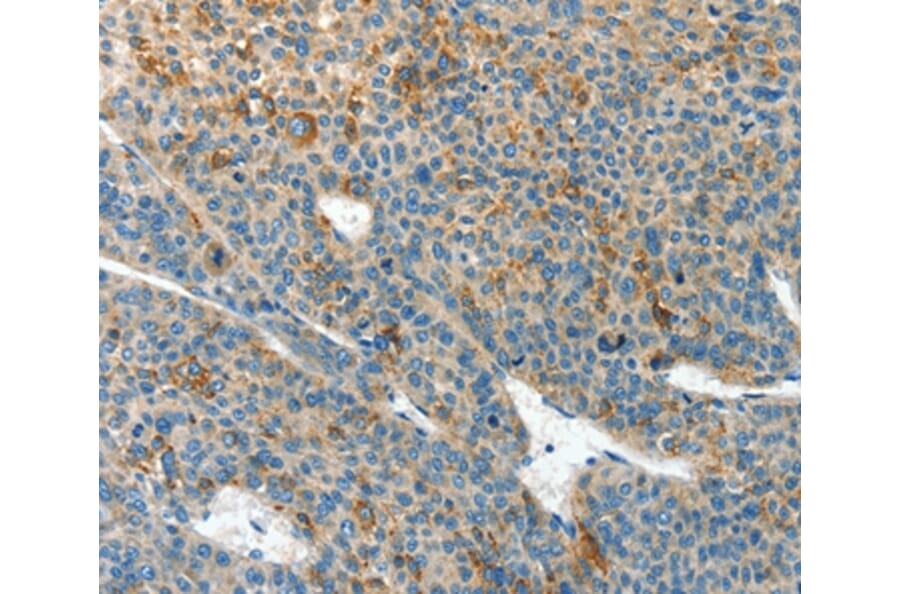 Immunohistochemistry - CLPTM1L Antibody from Signalway Antibody (37492) - Antibodies.com