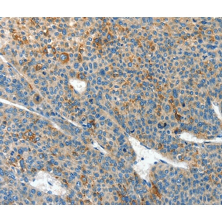 Immunohistochemistry - CLPTM1L Antibody from Signalway Antibody (37492) - Antibodies.com