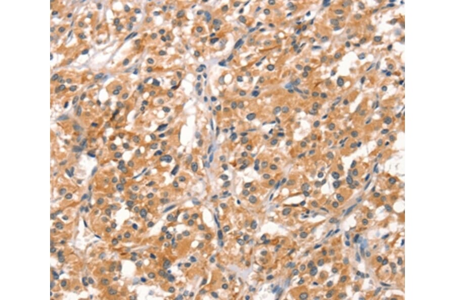 Immunohistochemistry - RHOBTB2 Antibody from Signalway Antibody (37521) - Antibodies.com