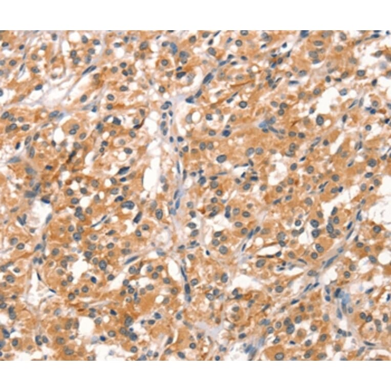 Immunohistochemistry - RHOBTB2 Antibody from Signalway Antibody (37521) - Antibodies.com