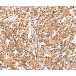 Immunohistochemistry - RHOBTB2 Antibody from Signalway Antibody (37521) - Antibodies.com