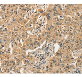 Immunohistochemistry - SLC11A2 Antibody from Signalway Antibody (37537) - Antibodies.com