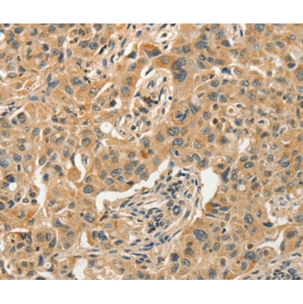 Immunohistochemistry - SLC11A2 Antibody from Signalway Antibody (37537) - Antibodies.com