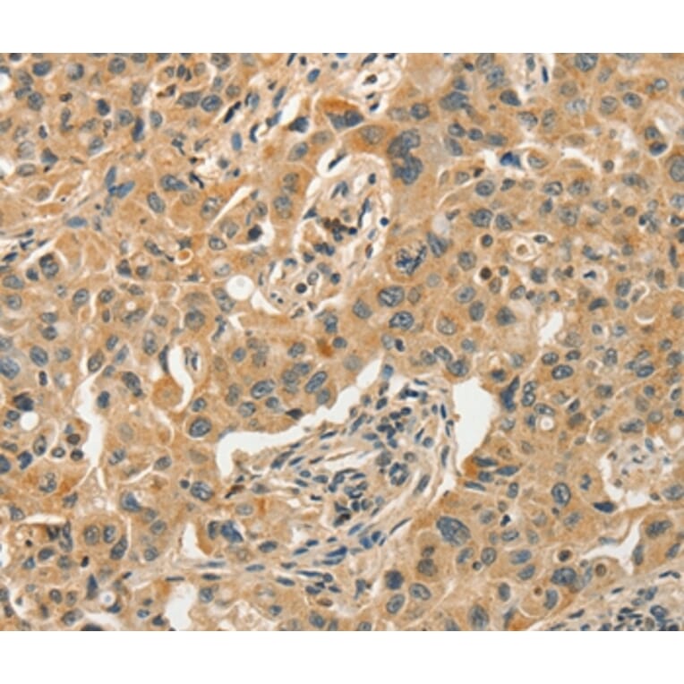 Immunohistochemistry - SLC11A2 Antibody from Signalway Antibody (37537) - Antibodies.com