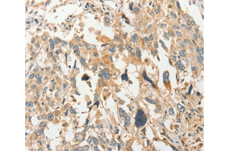 Immunohistochemistry - SLC11A2 Antibody from Signalway Antibody (37537) - Antibodies.com