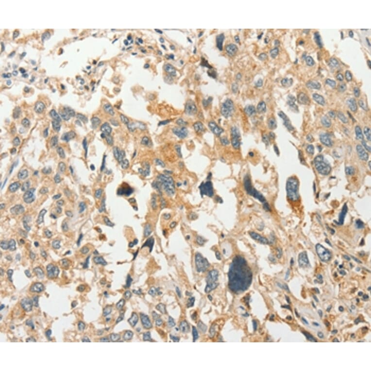 Immunohistochemistry - SLC11A2 Antibody from Signalway Antibody (37537) - Antibodies.com
