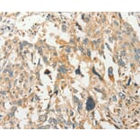 Immunohistochemistry - SLC11A2 Antibody from Signalway Antibody (37537) - Antibodies.com