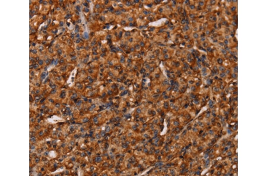Immunohistochemistry - COL18A1 Antibody from Signalway Antibody (37548) - Antibodies.com