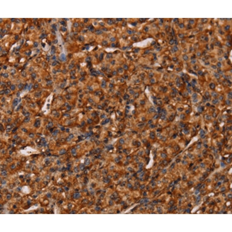 Immunohistochemistry - COL18A1 Antibody from Signalway Antibody (37548) - Antibodies.com