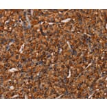 Immunohistochemistry - COL18A1 Antibody from Signalway Antibody (37548) - Antibodies.com