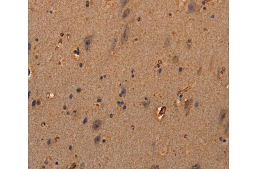 Immunohistochemistry - COL18A1 Antibody from Signalway Antibody (37548) - Antibodies.com