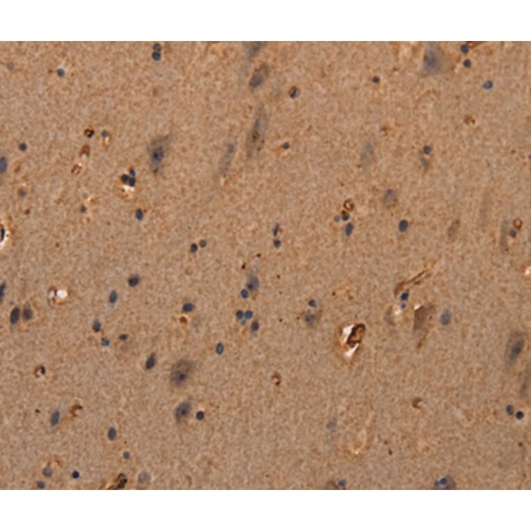 Immunohistochemistry - COL18A1 Antibody from Signalway Antibody (37548) - Antibodies.com