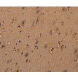 Immunohistochemistry - COL18A1 Antibody from Signalway Antibody (37548) - Antibodies.com