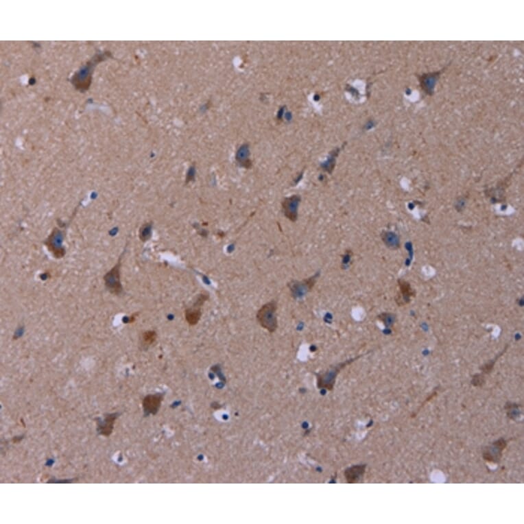 Immunohistochemistry - TUBGCP2 Antibody from Signalway Antibody (37589) - Antibodies.com