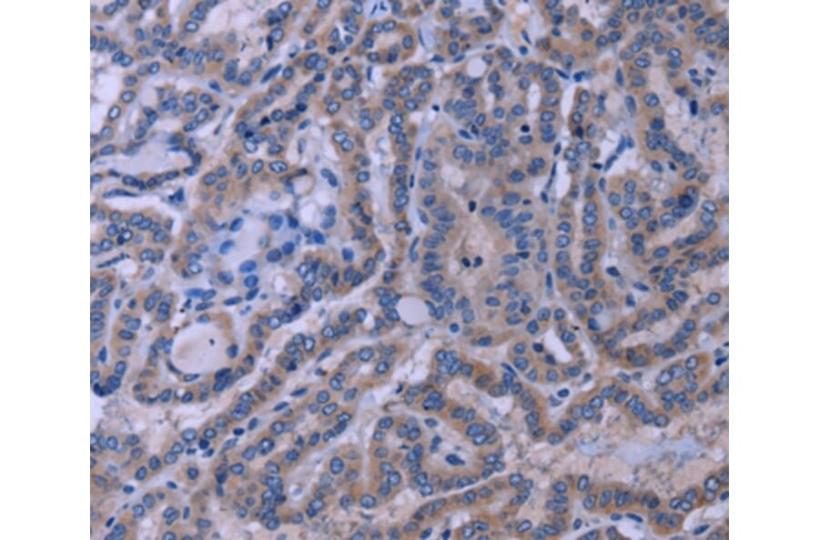 Immunohistochemistry - TUBGCP2 Antibody from Signalway Antibody (37589) - Antibodies.com