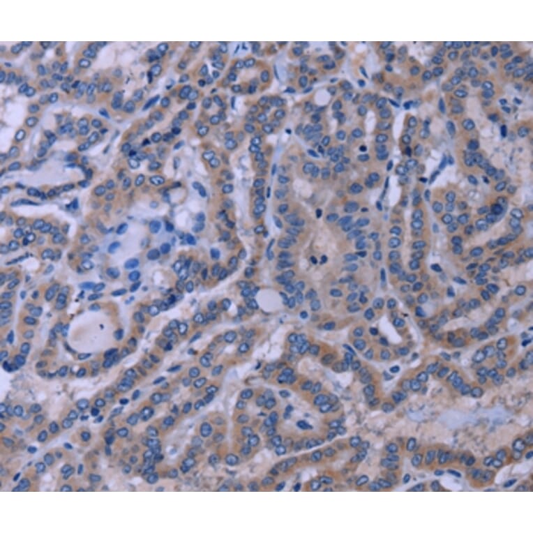 Immunohistochemistry - TUBGCP2 Antibody from Signalway Antibody (37589) - Antibodies.com