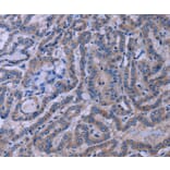 Immunohistochemistry - TUBGCP2 Antibody from Signalway Antibody (37589) - Antibodies.com