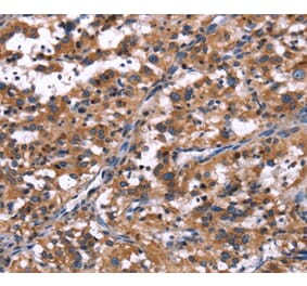 Immunohistochemistry - R3HCC1L Antibody from Signalway Antibody (37592) - Antibodies.com