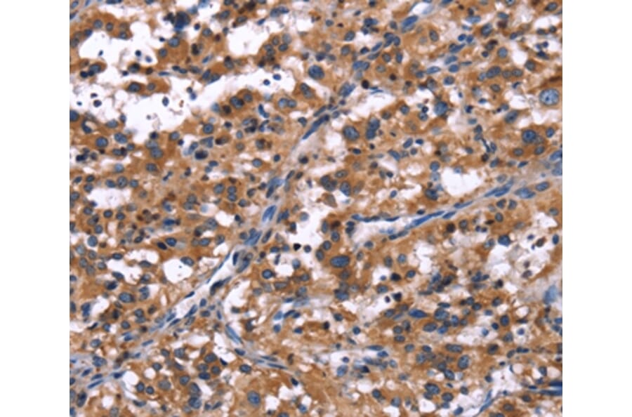 Immunohistochemistry - R3HCC1L Antibody from Signalway Antibody (37592) - Antibodies.com