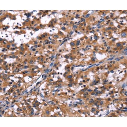 Immunohistochemistry - R3HCC1L Antibody from Signalway Antibody (37592) - Antibodies.com