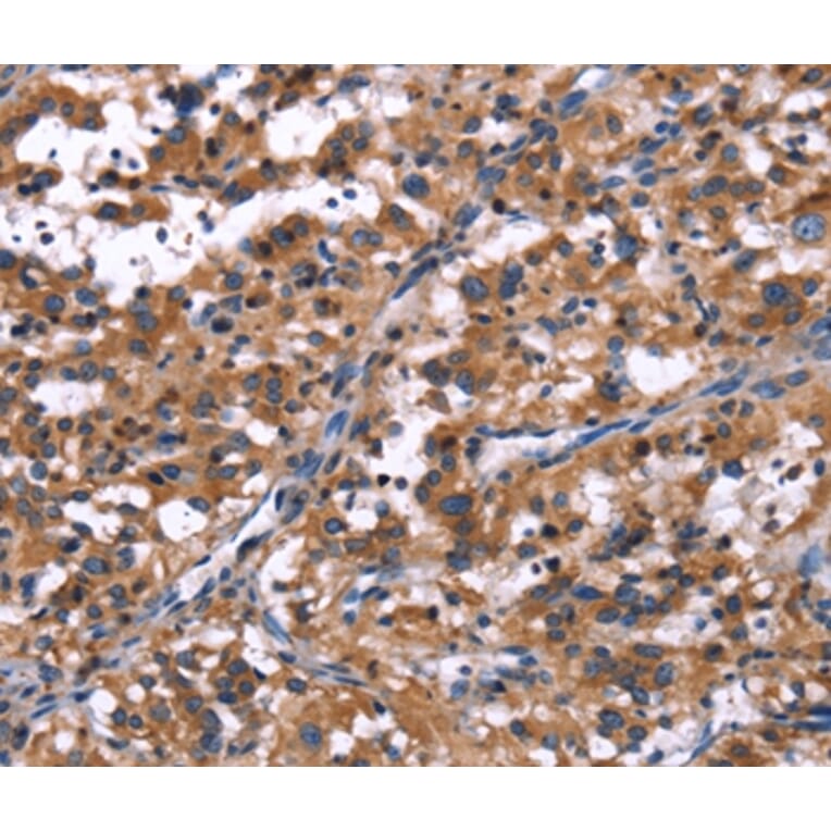Immunohistochemistry - R3HCC1L Antibody from Signalway Antibody (37592) - Antibodies.com