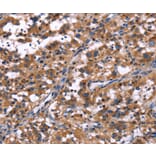 Immunohistochemistry - R3HCC1L Antibody from Signalway Antibody (37592) - Antibodies.com