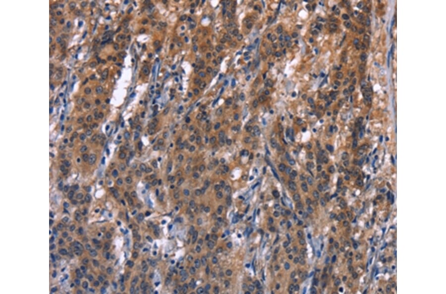Immunohistochemistry - R3HCC1L Antibody from Signalway Antibody (37592) - Antibodies.com