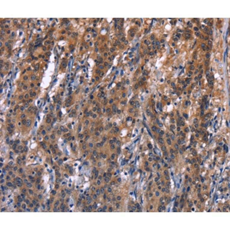 Immunohistochemistry - R3HCC1L Antibody from Signalway Antibody (37592) - Antibodies.com