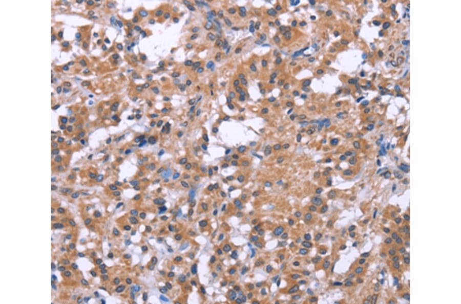 Immunohistochemistry - SLC52A1 Antibody from Signalway Antibody (37605) - Antibodies.com