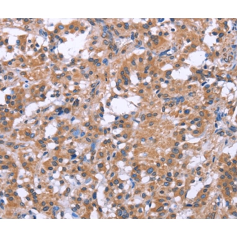 Immunohistochemistry - SLC52A1 Antibody from Signalway Antibody (37605) - Antibodies.com