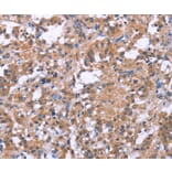 Immunohistochemistry - SLC52A1 Antibody from Signalway Antibody (37605) - Antibodies.com