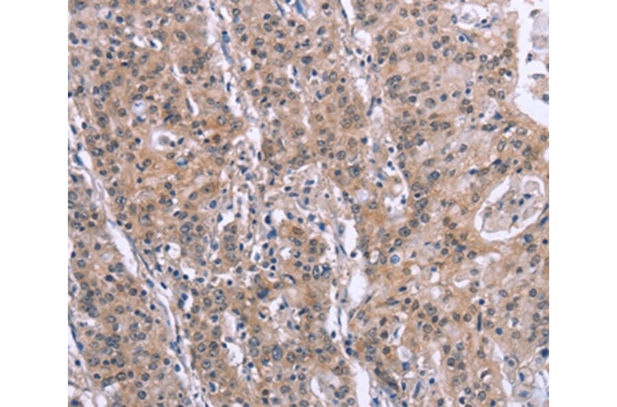 Immunohistochemistry - SLC52A1 Antibody from Signalway Antibody (37605) - Antibodies.com