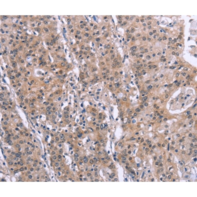 Immunohistochemistry - SLC52A1 Antibody from Signalway Antibody (37605) - Antibodies.com