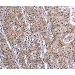 Immunohistochemistry - SLC52A1 Antibody from Signalway Antibody (37605) - Antibodies.com